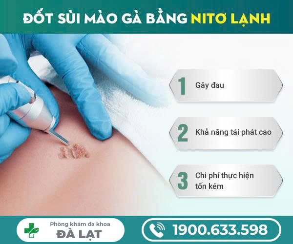 Hình ảnh minh họa